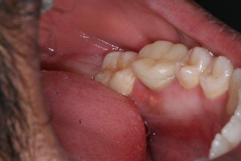 dental case picture